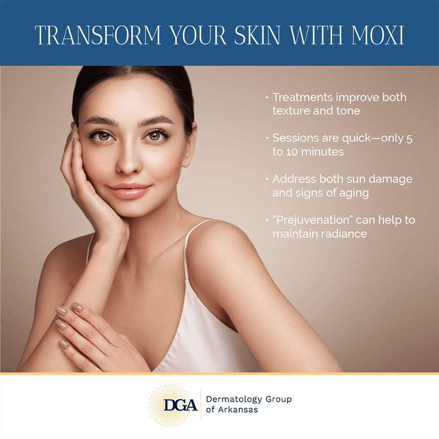Discover “prejuvenation” with Moxi™ at the Little Rock area’s Dermatology Group of Arkansas.