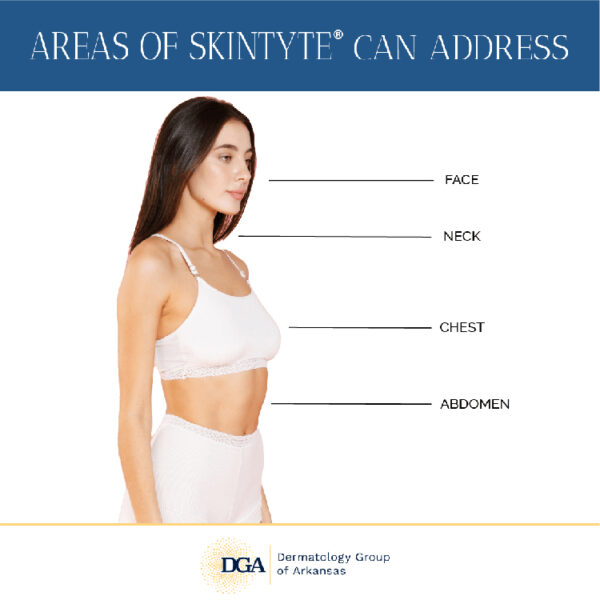Address skin laxity with the infrared-powered SkinTyte™ at the Little Rock area’s Dermatology Group of Arkansas.